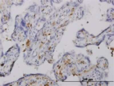 Immunohistochemistry-Paraffin: Pleckstrin Antibody (6E3) [H00005341-M01]