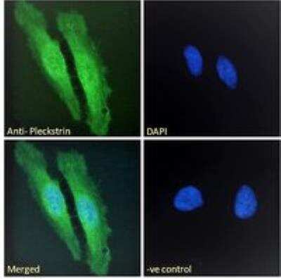 Immunocytochemistry/ Immunofluorescence: Pleckstrin Antibody [NB100-1343]
