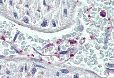 Immunohistochemistry-Paraffin: Pleckstrin Antibody [NB100-1343]