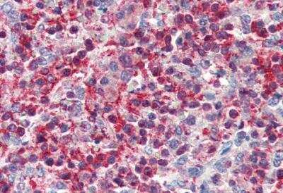 Immunohistochemistry-Paraffin: Pleckstrin Antibody [NB100-1343]