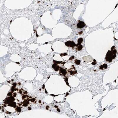 Immunohistochemistry-Paraffin: Pleckstrin Antibody [NBP1-87370]