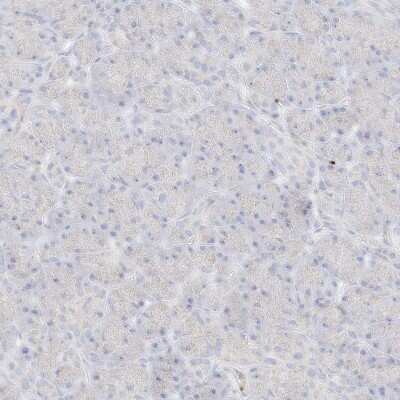 Immunohistochemistry-Paraffin: Pleckstrin Antibody [NBP1-87370]