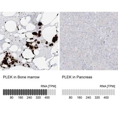Immunohistochemistry-Paraffin: Pleckstrin Antibody [NBP1-87370]