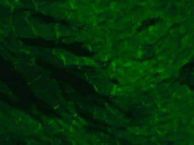 Immunohistochemistry: Plectin Antibody (7A8) [NB120-11220]