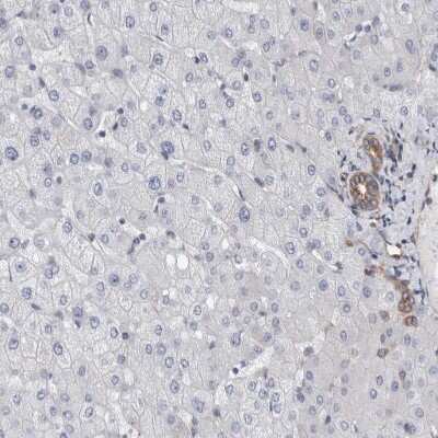 Immunohistochemistry-Paraffin: Plectin Antibody [NBP1-84020]
