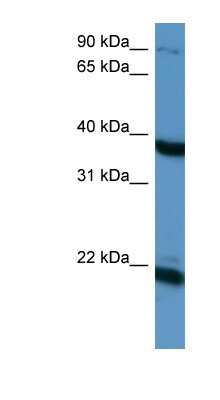 Western Blot: Pleiotrophin/PTN Antibody [NBP1-58286]