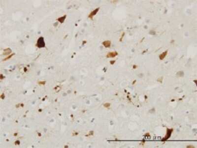 Immunohistochemistry-Paraffin: Pleiotrophin/PTN Antibody (2E3) [H00005764-M02]