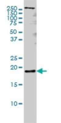Western Blot: Pleiotrophin/PTN Antibody (5C3) [H00005764-M01]