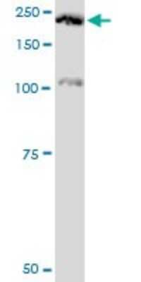 Western Blot: Plexin A2 Antibody (2G5) [H00005362-M06]