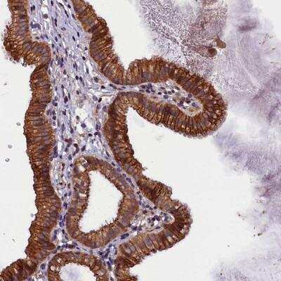 Immunohistochemistry-Paraffin: Plexin B1 Antibody [NBP1-87782]