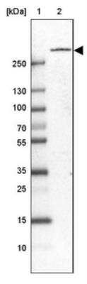 Western Blot: Plexin B1 Antibody [NBP1-87782]