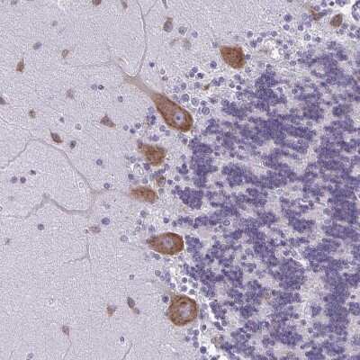 Immunohistochemistry-Paraffin: Plexin B3 Antibody [NBP2-38573]