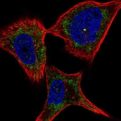 Immunocytochemistry/ Immunofluorescence: Plexin C1 Antibody [NBP2-57282]