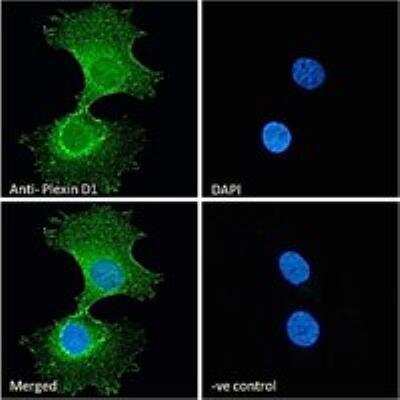 Immunocytochemistry/ Immunofluorescence: Plexin D1 Antibody [NB300-961]
