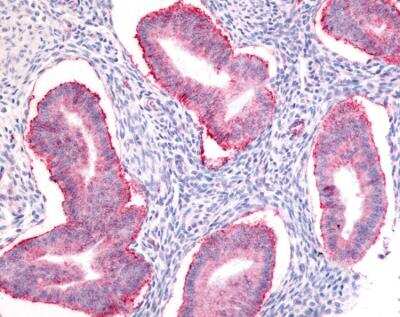 Immunohistochemistry: Pluripotent Stem Cell Transcription Factor Antibody Pack [NBP1-42823]