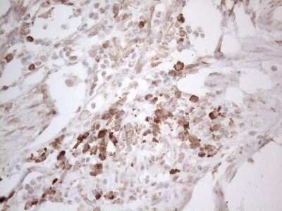 Immunohistochemistry: Podocalyxin Like Antibody (OTI2C6) [NBP2-45362]