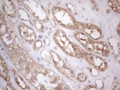 Immunohistochemistry: Podocalyxin Like Antibody (OTI2C6) [NBP2-45362]