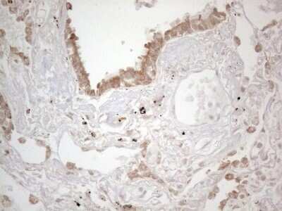 Immunohistochemistry: Podocalyxin Like Antibody (OTI2C6) [NBP2-45362]
