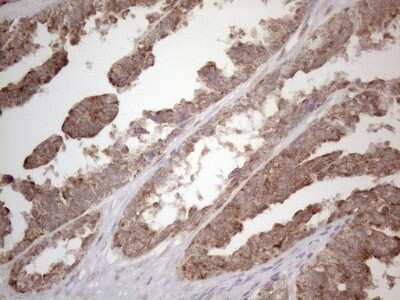 Immunohistochemistry: Podocalyxin Like Antibody (OTI2C6) [NBP2-45362]