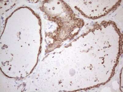 Immunohistochemistry: Podocalyxin Like Antibody (OTI2C6) [NBP2-45362]