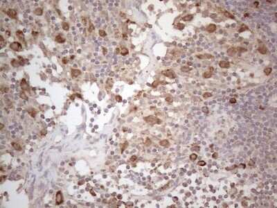 Immunohistochemistry: Podocalyxin Like Antibody (OTI2C6) [NBP2-45362]