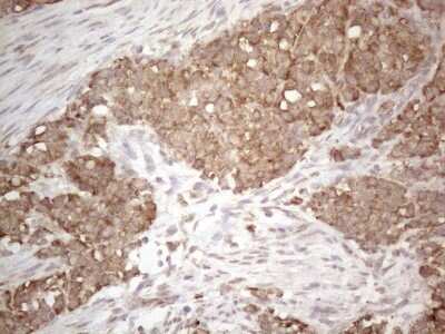 Immunohistochemistry: Podocalyxin Like Antibody (OTI2C6) [NBP2-45362]