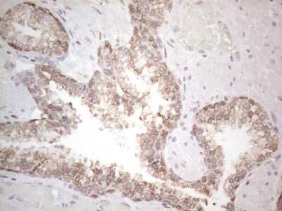 Immunohistochemistry: Podocalyxin Like Antibody (OTI2C6) [NBP2-45362]