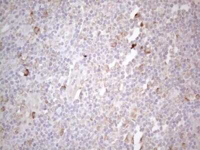 Immunohistochemistry: Podocalyxin Like Antibody (OTI2C6) [NBP2-45362]
