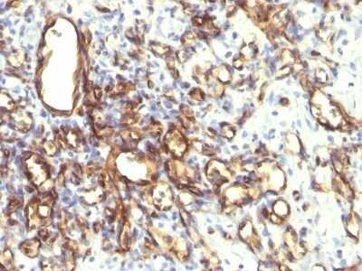 Immunohistochemistry-Paraffin: Podocalyxin Like Antibody (2A4) - Azide and BSA Free [NBP2-47750]