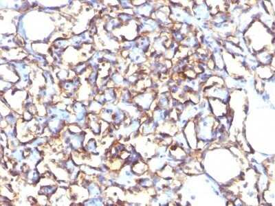 Immunohistochemistry-Paraffin: Podocalyxin Like Antibody (3D3) - Azide and BSA Free [NBP2-33108]