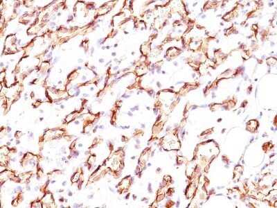 Immunohistochemistry-Paraffin: Podocalyxin Like Antibody (3D3) - IHC-Prediluted [NBP2-45167]
