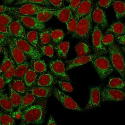 Immunocytochemistry/ Immunofluorescence: Podocalyxin Like Antibody (3D3) [NBP2-25219]
