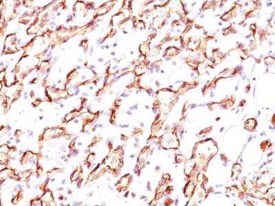 Immunohistochemistry-Paraffin: Podocalyxin Like Antibody (3D3) [NBP2-25219]