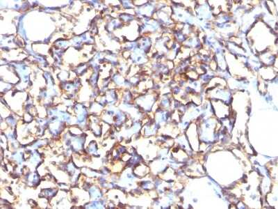 Immunohistochemistry-Paraffin: Podocalyxin Like Antibody (3D3) [NBP2-25219]