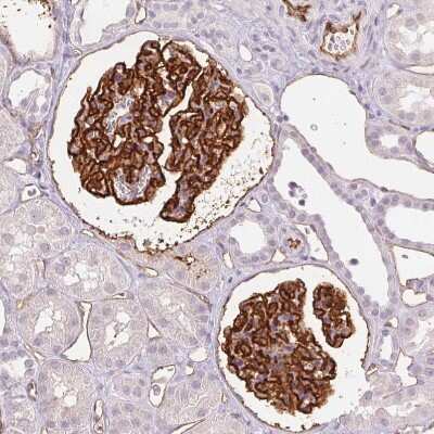 Immunohistochemistry-Paraffin: Podocalyxin Like Antibody (CL0284) [NBP2-52903]