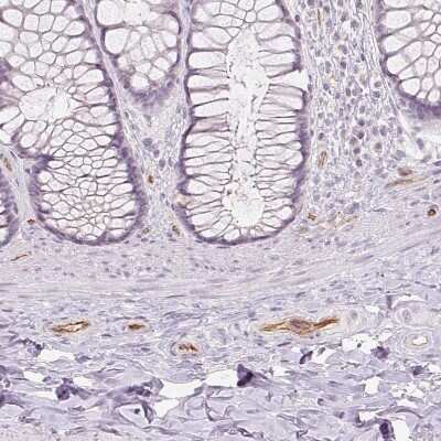 Immunohistochemistry-Paraffin: Podocalyxin Like Antibody (CL0284) [NBP2-52903]