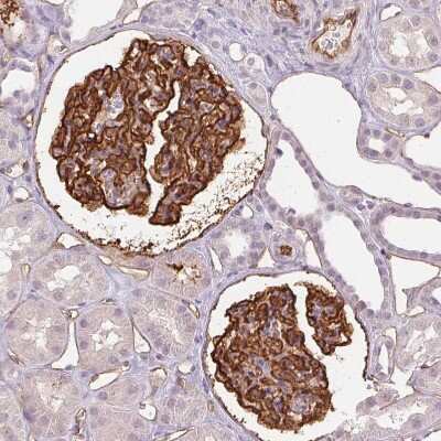 Immunohistochemistry-Paraffin: Podocalyxin Like Antibody (CL0285) [NBP2-52904]
