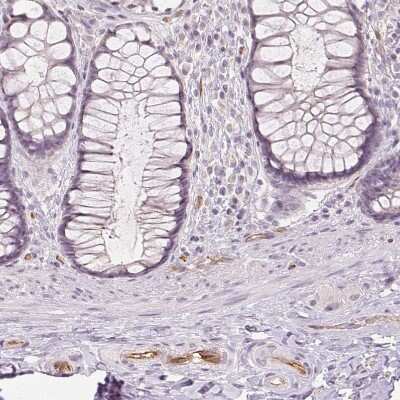 Immunohistochemistry-Paraffin: Podocalyxin Like Antibody (CL0285) [NBP2-52904]