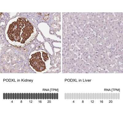 Immunohistochemistry-Paraffin: Podocalyxin Like Antibody (CL0285) [NBP2-52904]