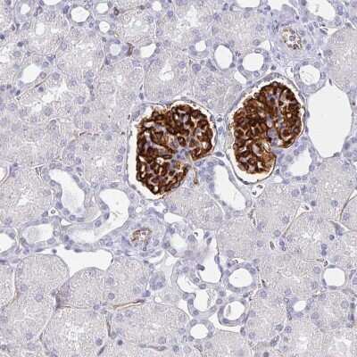Immunohistochemistry-Paraffin: Podocalyxin Like Antibody (CL0308) [NBP2-52912]