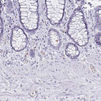 Immunohistochemistry-Paraffin: Podocalyxin Like Antibody (CL0308) [NBP2-52912]