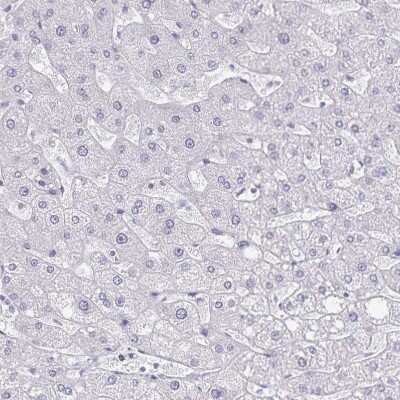 Immunohistochemistry-Paraffin: Podocalyxin Like Antibody (CL0308) [NBP2-52912]