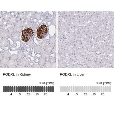 Immunohistochemistry-Paraffin: Podocalyxin Like Antibody (CL0308) [NBP2-52912]