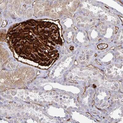 Immunohistochemistry-Paraffin: Podocalyxin Like Antibody [NBP1-83348]