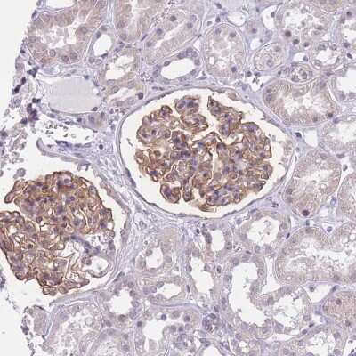 Immunohistochemistry-Paraffin: Podocalyxin Like Antibody [NBP2-13784]