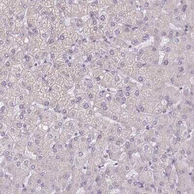 Immunohistochemistry-Paraffin: Podocalyxin Like Antibody [NBP2-13784]