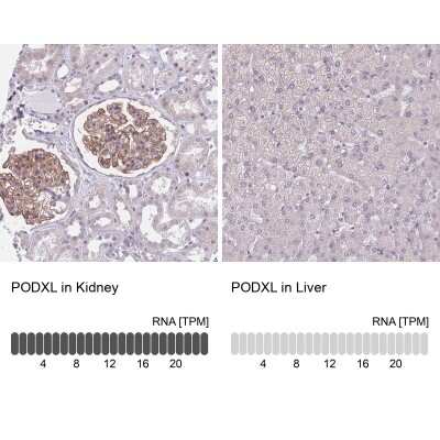 Immunohistochemistry-Paraffin: Podocalyxin Like Antibody [NBP2-13784]