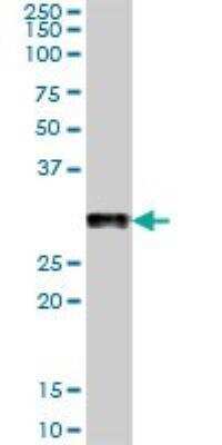 Western Blot: Podocin/NPHS2 Antibody [H00007827-B01P]
