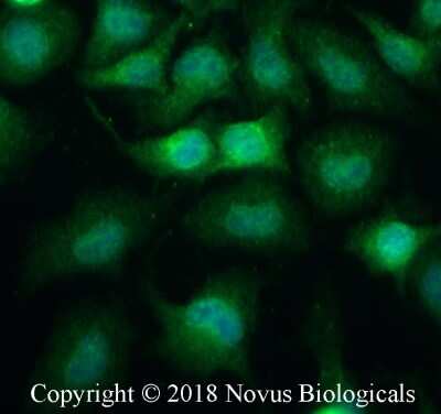 Immunocytochemistry/ Immunofluorescence: Podoplanin Antibody (8.1.1) - BSA Free [NB600-1015]