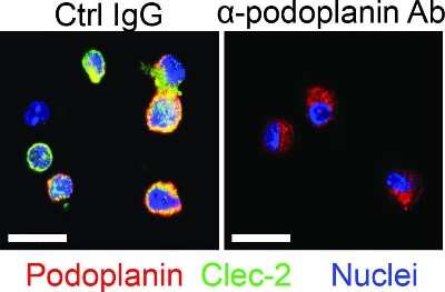 Immunocytochemistry/ Immunofluorescence: Podoplanin Antibody (8.1.1) - BSA Free [NB600-1015]